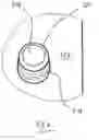 Fig. 10 - Fluid cassette with alignment latching having an improved tilt-tolerance as well as a blood treatment apparatus