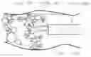 Fig. 01 - Systems and methods for cleaning body cavities