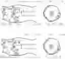 Fig. 04 - Systems and methods for cleaning body cavities