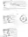 Fig. 15 - Systems and methods for cleaning body cavities