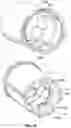Fig. 18 - Injection device with dose interruption fail safe