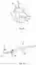Fig. 05 - Medicament injection device