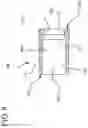 Fig. 06 - Medical device assembly