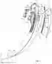Fig. 03 - Endotracheal tube-inserting device