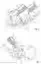 Fig. 04 - Endotracheal tube-inserting device