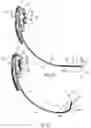 Fig. 11 - Endotracheal tube-inserting device
