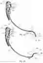 Fig. 12 - Endotracheal tube-inserting device