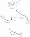 Fig. 13 - Endotracheal tube-inserting device