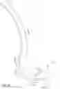 Fig. 16 - Endotracheal tube-inserting device