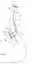 Fig. 17 - Endotracheal tube-inserting device