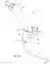Fig. 18 - Endotracheal tube-inserting device