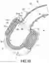 Fig. 11 - Nasal cannula device