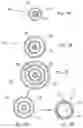 Fig. 04 - CATHETERS WITH LUBRICIOUS LININGS AND METHODS FOR MAKING AND USING THEM