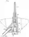 Fig. 01 - Systems and methods to improve instrument guidance within an intravenous catheter assembly