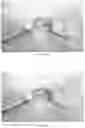 Fig. 13 - Balloon catheters and methods of manufacture and use