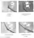 Fig. 16 - Balloon catheters and methods of manufacture and use