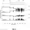 Fig. 09 - Transcutaneous electrical nerve stimulator with automatic detection of user sleep-wake state