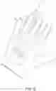 Fig. 07 - Article and method for treating diabetic peripheral neuropathy