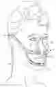 Fig. 01 - METHOD AND APPARATUS FOR TOOTH REGULATION WITH HEAVY FORCES