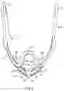 Fig. 04 - METHOD AND APPARATUS FOR TOOTH REGULATION WITH HEAVY FORCES