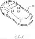 Fig. 07 - METHOD AND APPARATUS FOR TOOTH REGULATION WITH HEAVY FORCES