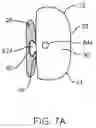 Fig. 08 - METHOD AND APPARATUS FOR TOOTH REGULATION WITH HEAVY FORCES