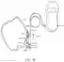 Fig. 23 - METHOD AND APPARATUS FOR TOOTH REGULATION WITH HEAVY FORCES