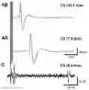 Fig. 01 - SYSTEMS AND METHODS FOR ULTRASOUND MODULATION OF NEURONS