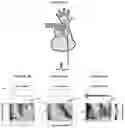 Fig. 04 - SYSTEMS AND METHODS FOR ULTRASOUND MODULATION OF NEURONS