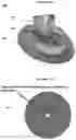 Fig. 15 - SYSTEMS AND METHODS FOR ULTRASOUND MODULATION OF NEURONS