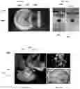 Fig. 21 - SYSTEMS AND METHODS FOR ULTRASOUND MODULATION OF NEURONS