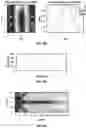 Fig. 18 - Implants using ultrasonic backscatter for detecting electrophysiological signals