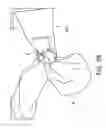 Fig. 05 - Cloth back support apparatus and methods of use