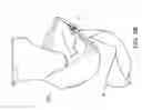Fig. 12 - Cloth back support apparatus and methods of use