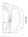 Fig. 14 - Cloth back support apparatus and methods of use