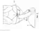 Fig. 16 - Cloth back support apparatus and methods of use