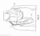 Fig. 23 - Cloth back support apparatus and methods of use