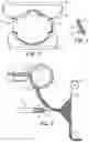 Fig. 03 - REMOTE FLUORINATION OF FIBROUS FILTER WEBS