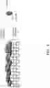 Fig. 04 - Zeolite membrane having AFX structure, membrane structure, and method for manufacturing membrane structure