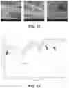 Fig. 11 - Electroactive materials comprising a piezoelectric polymer and a conducting polymer
