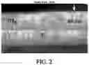 Fig. 03 - Razor blade coating