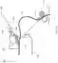 Fig. 12 - Temporary fixation of a portion of a printable medium