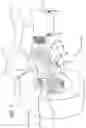 Fig. 03 - Low suspension arm strut coupling