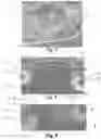 Fig. 03 - Method for forming a welding spout on a parison during the blowing of a tank