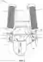 Fig. 06 - FLOTATION SYSTEM