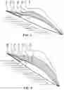 Fig. 04 - AERODYNAMIC SURFACE OF AN AIRCRAFT