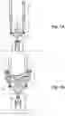 Fig. 12 - Tilting landing gear systems and methods