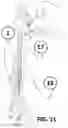 Fig. 12 - Insert lock tab wrap folder and adhesive tab wrap folder