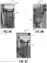 Fig. 12 - Filter system including an activated carbon block for removing particles, organic contaminants, and microorganisms from a fluid