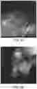 Fig. 05 - NANOPARTICLES AND PREPARATION METHOD